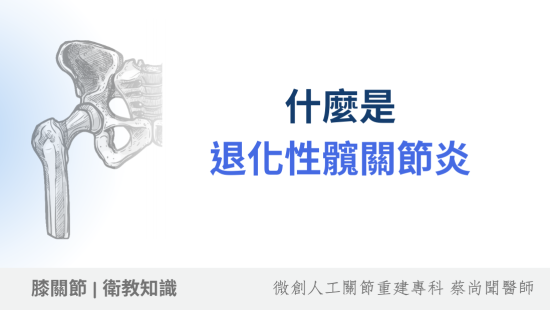 退化性髖關節炎
