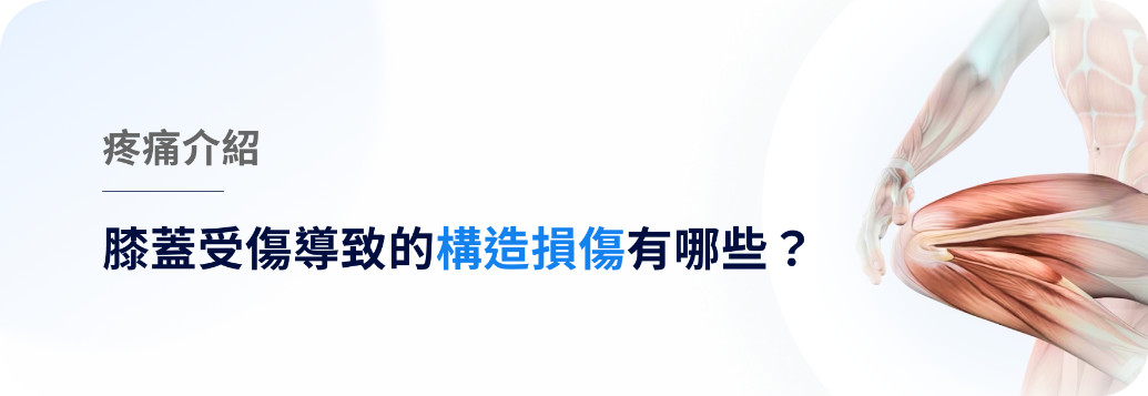 膝蓋受傷導致的構造損傷:原因、症狀、診斷和治療方法