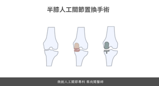 半膝