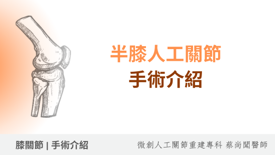 半膝人工關節置換術：更微創更自然、只換內側，膝關節退化新選擇！