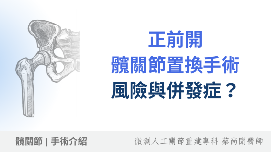 正前開人工髖關節置換術有風險嗎？併發症、後遺症與術後注意事項