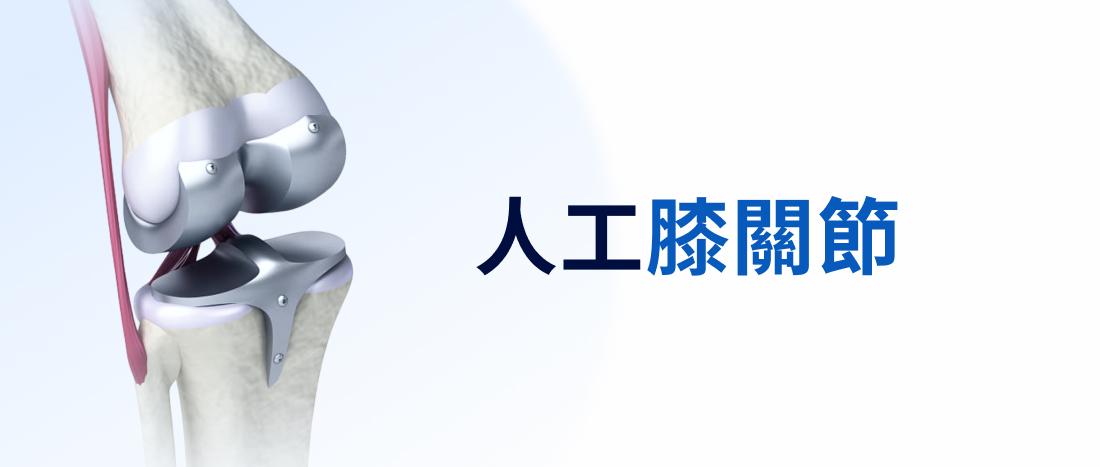 人工膝關節