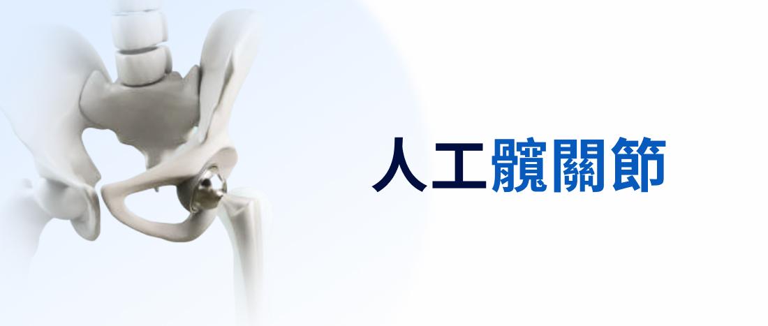 人工髖關節