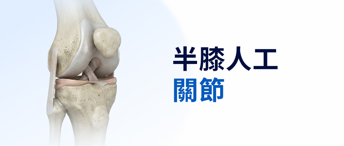 半膝人工關節